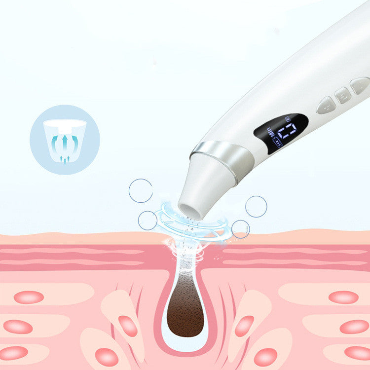 Blackhead Remover Vacuum – Clear Skin in Minutes