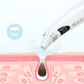 Blackhead Remover Vacuum – Clear Skin in Minutes