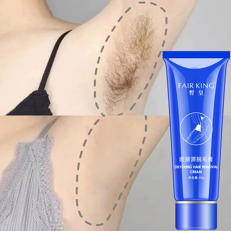 Underarm Whitening Cream – Dark Spot Remover for Armpits & Legs (Smooth Skin Care)
