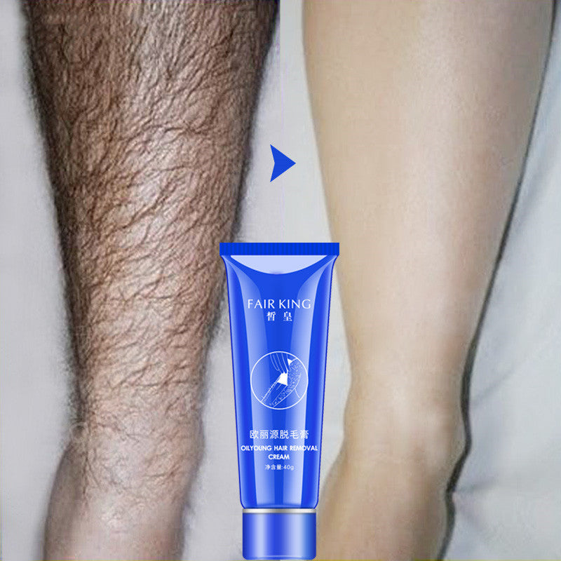 Underarm Whitening Cream – Dark Spot Remover for Armpits & Legs (Smooth Skin Care)